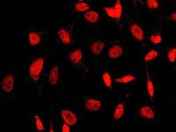 SUMO2 Antibody, Novus Biologicals 50 &mu;g | Buy Online | Novus Biologicals | Fisher Scientific