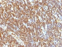 SUMO2 Antibody (SUMO2/1199), Novus Biologicals:Antibodies:Primary Antibodies