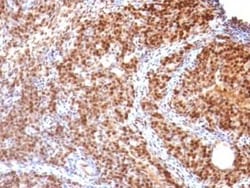 SUMO2 Antibody (SUMO2/1199), Novus Biologicals:Antibodies:Primary Antibodies