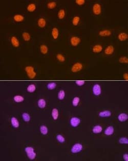 SUMO4 Rabbit anti-Human, Mouse, Rat, Clone: 7X3V7, Novus Biologicals 20