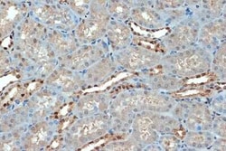 SUMO4 Rabbit anti-Human, Mouse, Rat, Clone: 7X3V7, Novus Biologicals 20