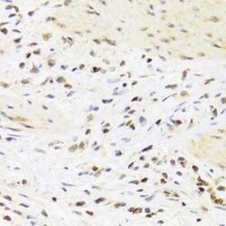 SUMO4 Antibody - BSA Free, Novus Biologicals 0.02 mL; Unconjugated:Antibodies,