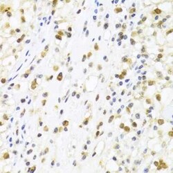 SUMO4 Antibody - BSA Free, Novus Biologicals 0.02 mL; Unconjugated:Antibodies,