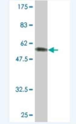 SUN1 Antibody (2D10), Novus Biologicals 0.1 mg | Buy Online | Novus Biologicals | Fisher Scientific