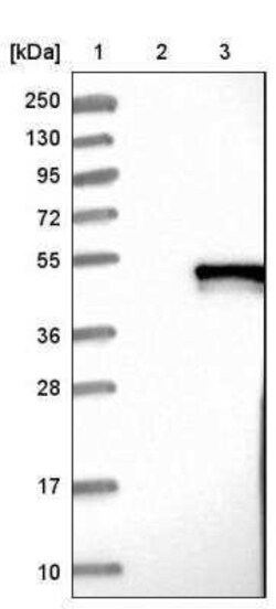 SUNC1 Antibody, Novus Biologicals 0.1 mL; Unconjugated:Antibodies, Polyclonal
