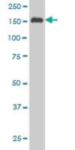 Novus Biologicals SUPT5H Antibody (3B1), Novus Biologicals 0.1 mg | Buy Online | Novus Biologicals&trade; | Fisher Scientific