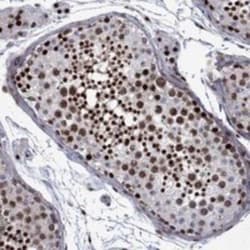 SURF2 Rabbit anti-Human, Polyclonal, Novus Biologicals 25 &mu;g; Unconjugated:Antibodies,