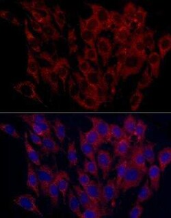 SURF4 Antibody - Azide and BSA Free, Novus Biologicals:Antibodies:Primary