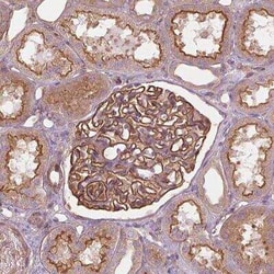 SURF4 Antibody, Novus Biologicals 25 &mu;L, Unconjugated:Antibodies, Polyclonal