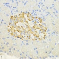 SURF4 Antibody - Azide and BSA Free, Novus Biologicals:Antibodies:Primary