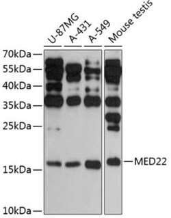 SURF5 Antibody - Azide and BSA Free, Novus Biologicals:Antibodies:Primary