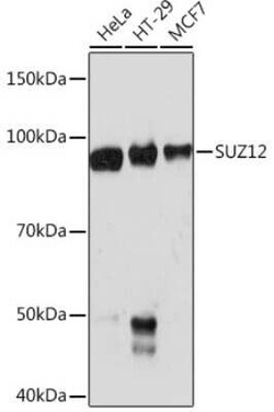 SUZ12 Rabbit anti-Human, Mouse, Rat, Clone: 1M3V2, Novus Biologicals 100