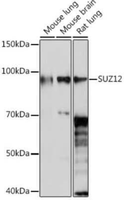 SUZ12 Rabbit anti-Human, Mouse, Rat, Clone: 1M3V2, Novus Biologicals 100