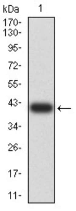 SUZ12 Antibody (2B9G12) - BSA Free, Novus Biologicals 0.1 ml; Unconjugated:Antibodies,