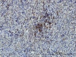 SWAP70 Antibody (3H8), Novus Biologicals 100 &mu;g | Buy Online | Novus Biologicals | Fisher Scientific