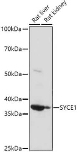 SYCE1 Antibody - BSA Free, Novus Biologicals 0.02 mL, Unconjugated:Antibodies,