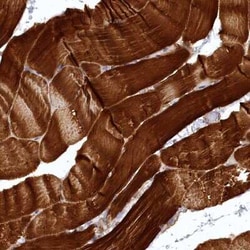 SYNPO2 Antibody, Novus Biologicals:Antibodies:Primary Antibodies