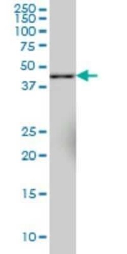 SYT11 Antibody (4E1), Novus Biologicals 0.1 mg | Buy Online | Novus Biologicals | Fisher Scientific