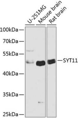 SYT11 Antibody - Azide and BSA Free, Novus Biologicals:Antibodies:Primary