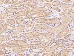SYT17 Antibody, Novus Biologicals 100 &mu;g, Unconjugated:Antibodies, Polyclonal