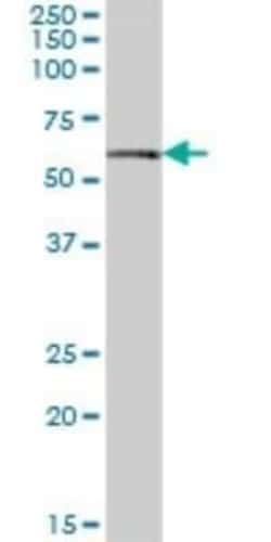 Salivary Amylase Beta Antibody, Novus Biologicals 50 &mu;g | Buy Online | Novus Biologicals | Fisher Scientific