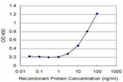 Scaffold attachment factor B2 Antibody (4H3), Novus Biologicals 0.1 mg,