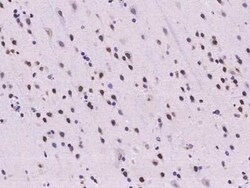Scaffold attachment factor B2 Antibody, Novus Biologicals:Antibodies:Primary