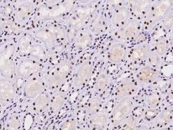 Scaffold attachment factor B2 Antibody, Novus Biologicals:Antibodies:Primary