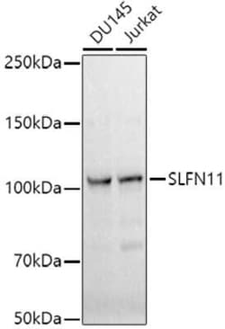 Schlafen 11 Rabbit anti-Human, Clone: 5P3W6, Novus Biologicals 20 &mu;g | Buy Online | Bio-Techne | Fisher Scientific