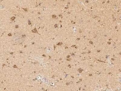 Scn2b Antibody, Novus Biologicals:Antibodies:Primary Antibodies