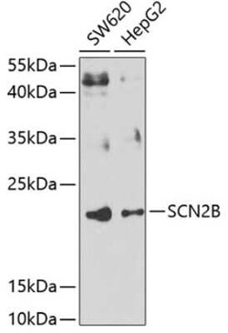 Scn2b Antibody - BSA Free, Novus Biologicals:Antibodies:Primary Antibodies