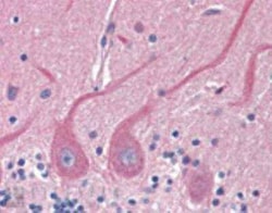Sec8 Antibody (14G1), Novus Biologicals:Antibodies:Primary Antibodies