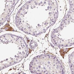 Seladin 1 Antibody, Novus Biologicals:Antibodies:Primary Antibodies