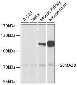 Semaphorin 3B Antibody - BSA Free, Novus Biologicals 0.02 mL; Unconjugated:Antibodies,