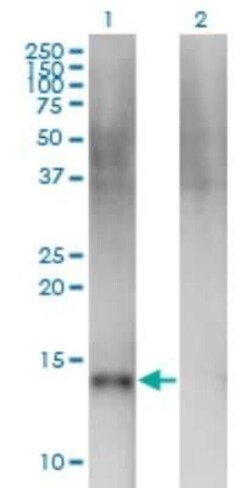 Semaphorin 4B Antibody (4B2), Novus Biologicals 0.1 mg | Buy Online | Novus Biologicals | Fisher Scientific