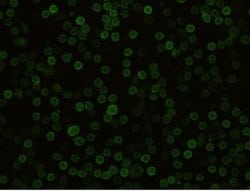 Semaphorin 4D/CD100 Rabbit anti-Mouse, Clone: 10, Novus Biologicals:Antibodies:Primary