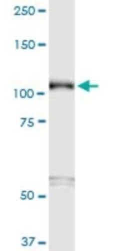 Semaphorin 6B Antibody (2H7), Novus Biologicals 0.1 mg | Buy Online | Novus Biologicals | Fisher Scientific