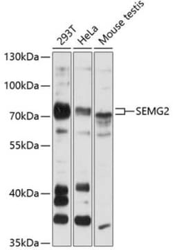 Semenogelin II Antibody - Azide and BSA Free, Novus Biologicals:Antibodies:Primary