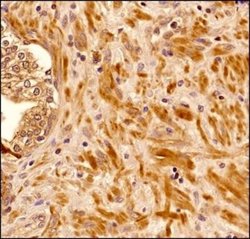 Senataxin Antibody (5D8) - Azide and BSA Free, Novus Biologicals 0.1 mg;