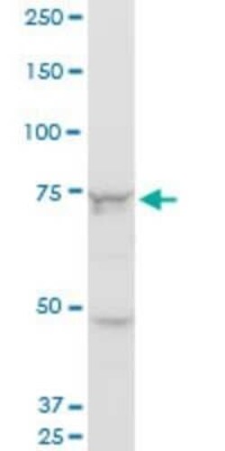 Senataxin Antibody (2A9), Novus Biologicals 0.1 mg | Buy Online | Novus Biologicals | Fisher Scientific