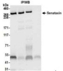 Senataxin Antibody (BLR050F), Novus Biologicals 100 &mu;g | Buy Online | Novus Biologicals | Fisher Scientific