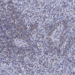 Septin-1 Rabbit anti-Human, Polyclonal, Novus Biologicals 100 &mu;g; Unconjugated:Antibodies,