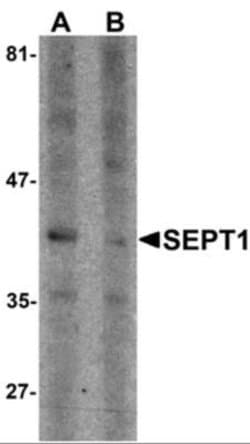 Septin-1 Antibody - BSA Free, Novus Biologicals 0.1 mg; Unconjugated:Antibodies,