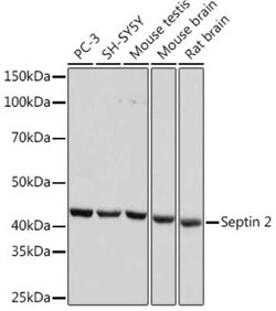 Septin-2 Rabbit anti-Human, Mouse, Rat, Clone: 9N1B3, Novus Biologicals:Antibodies:Primary