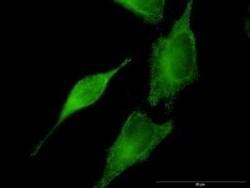 Septin-8 Antibody (3G1), Novus Biologicals 0.1 mg | Buy Online | Novus Biologicals | Fisher Scientific