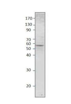 Septin-8 Antibody, Novus Biologicals 100 &mu;g | Buy Online | Bio-Techne | Fisher Scientific