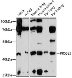 Serine protease 23 Antibody - Azide and BSA Free, Novus Biologicals:Antibodies:Primary