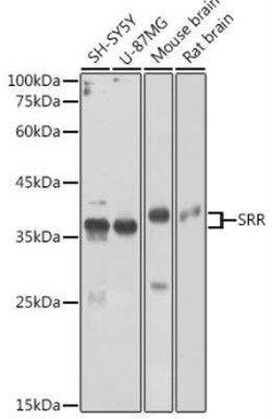 Serine racemase Antibody - BSA Free, Novus Biologicals:Antibodies:Primary