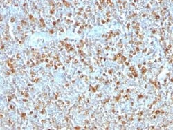 Serpin A1/alpha 1-Antitrypsin Antibody (AAT/1379), Novus Biologicals:Antibodies:Primary