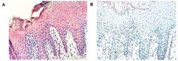 Serpin A12, Mouse anti-Human, Clone: VP63, Novus Biologicals:Antibodies:Primary